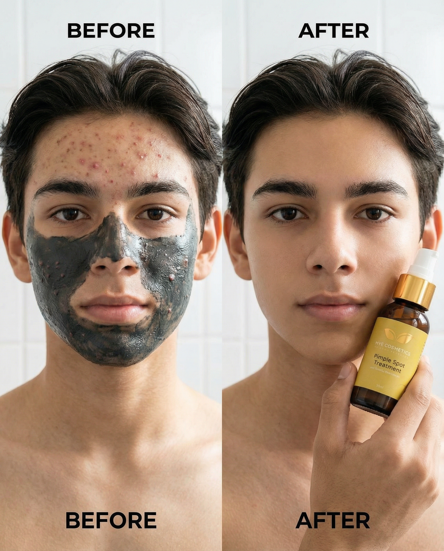 Pimple Spot Mask